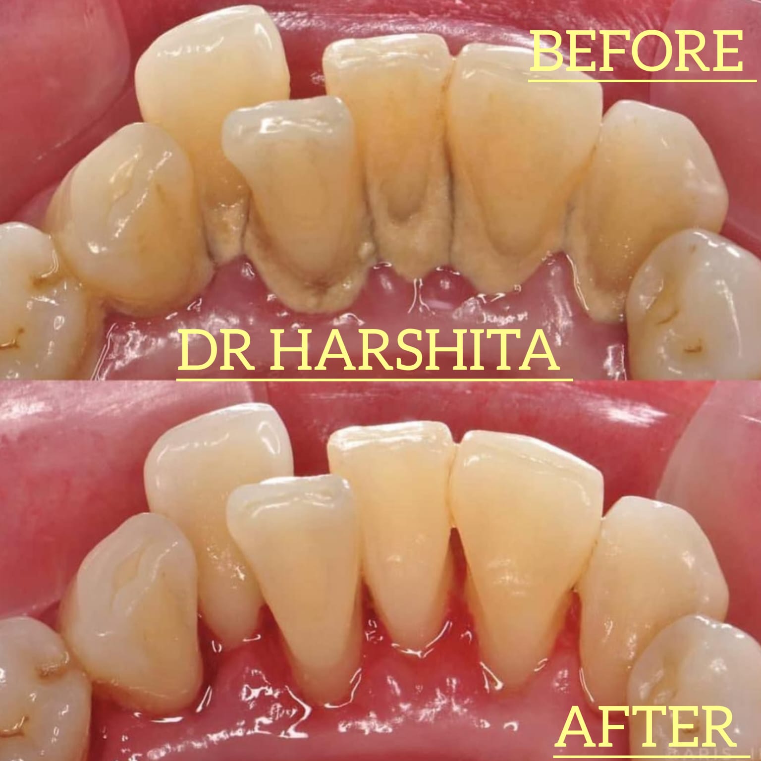 Before & After - Skin Treatment